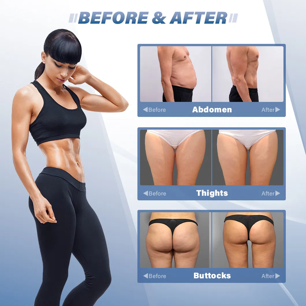 Before and After Results