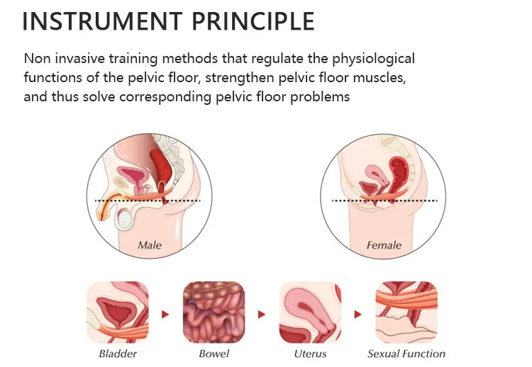Kegel Exercise Device