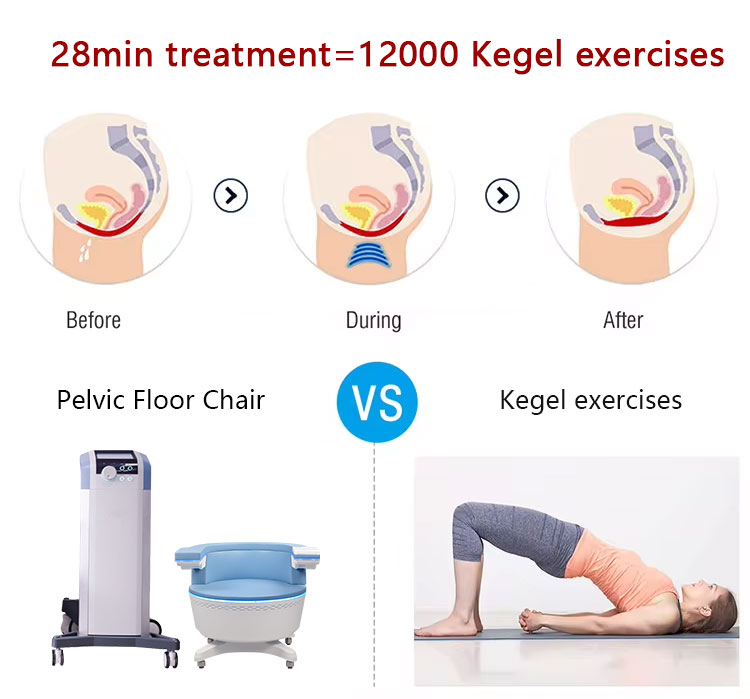 Kegel Exercise Device for Urinary Leakage Repair Muscle Trainer Pelvic Floor Chair