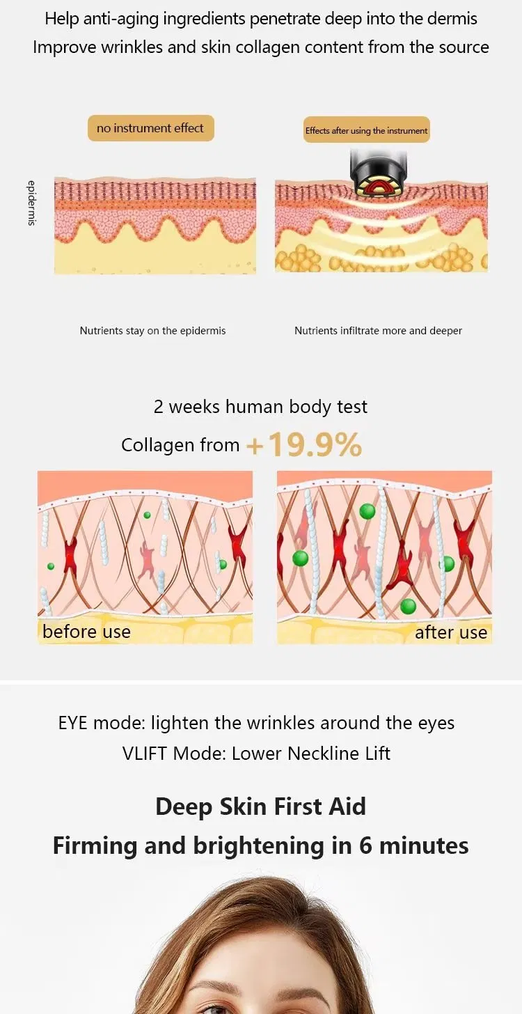 3MHz Home Use RF Beauty Equipment Anti-Aging Tightens Skin Multi RF Functional EMS LED Beauty Device