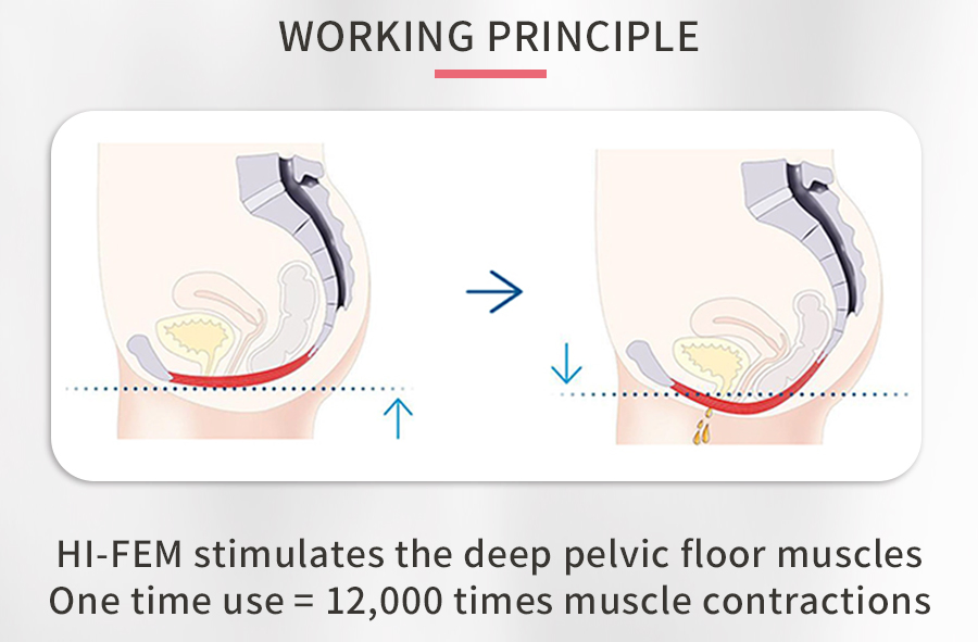 Practical Home Electrical Stimulation Urinary Incontinence Electromagnetic Pelvic Floor Muscle Machine