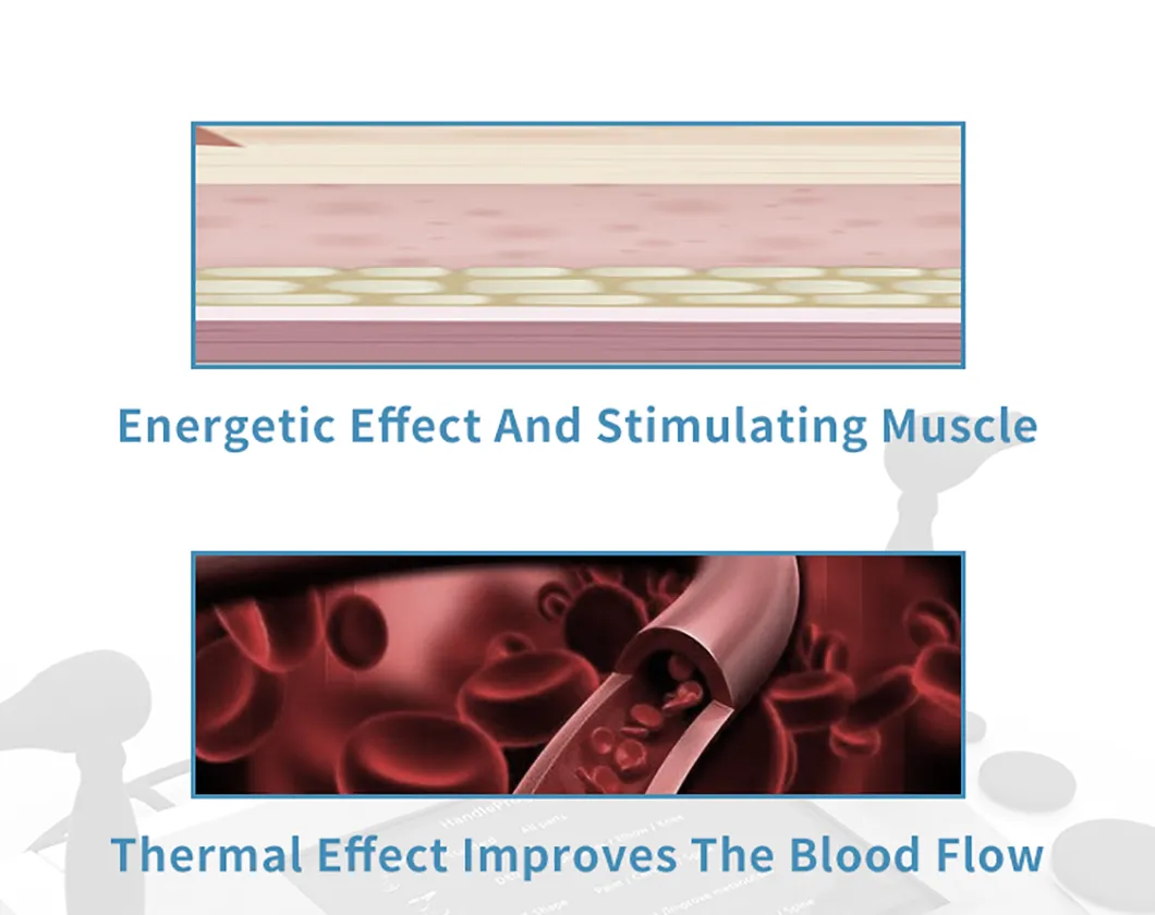 Capacitive Treatment