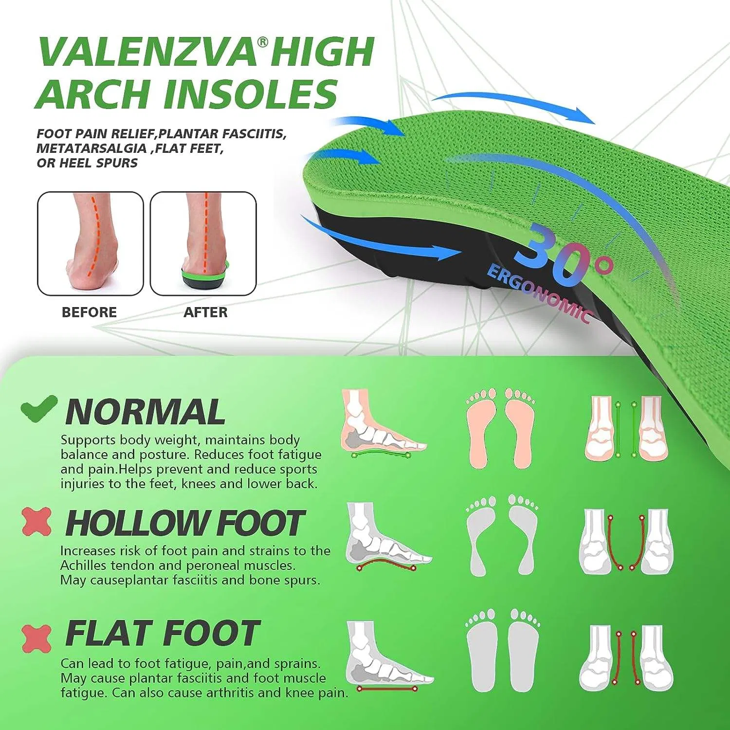 Plantar Fasciitis Pain Relief Feet Insoles Orthotics Arch Support Insoles with Motion Control Shoe Inserts Work Boot Flat Feet