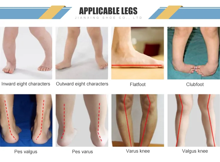 Orthopedic Shoes with Removable Insole 7