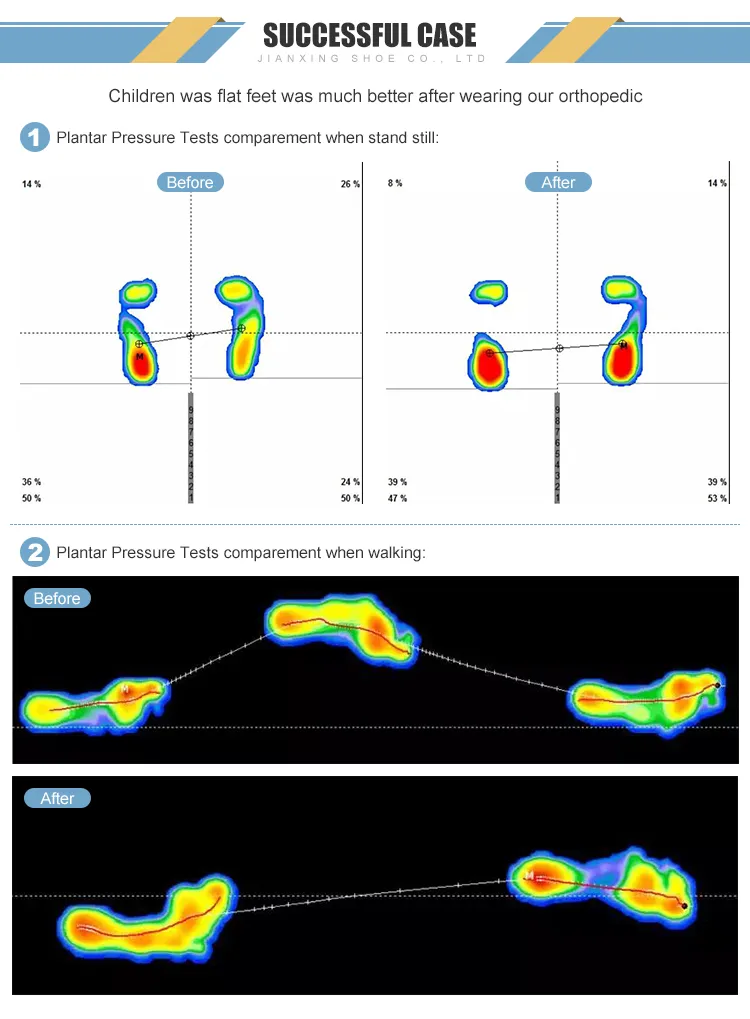 Diabetic Shoes View 11