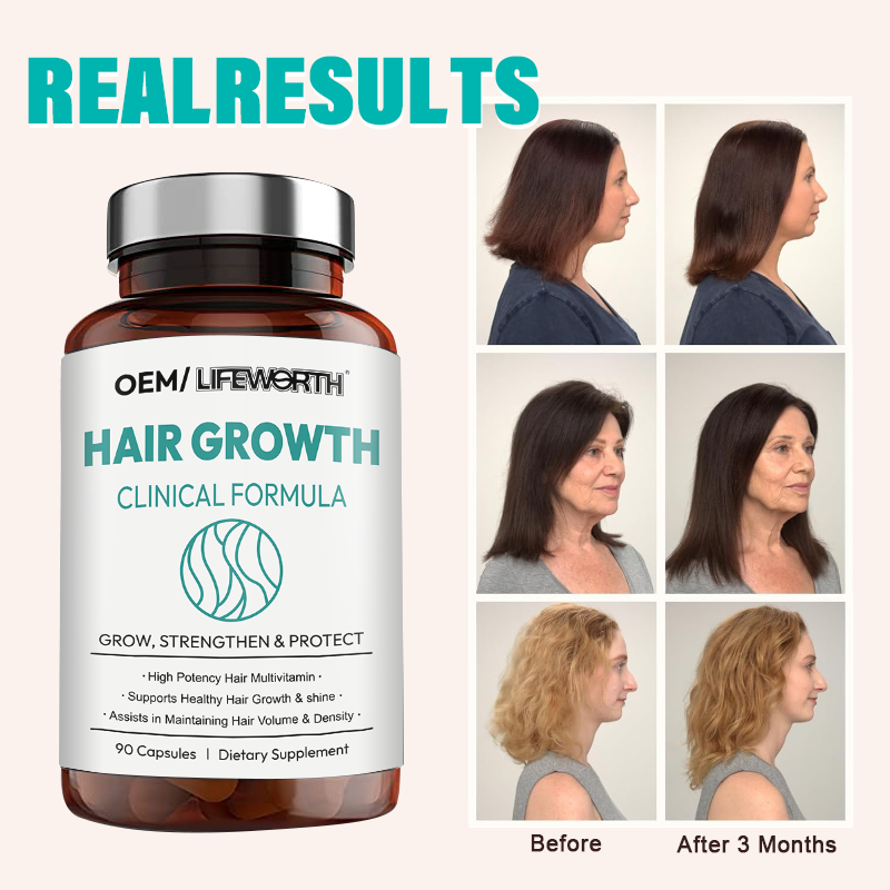 LIFEWORTH Hair Health Protect The Hair Follicles Vitamins For Women And Men Biotin 5000mcg Collagen &amp; Saw Palmetto