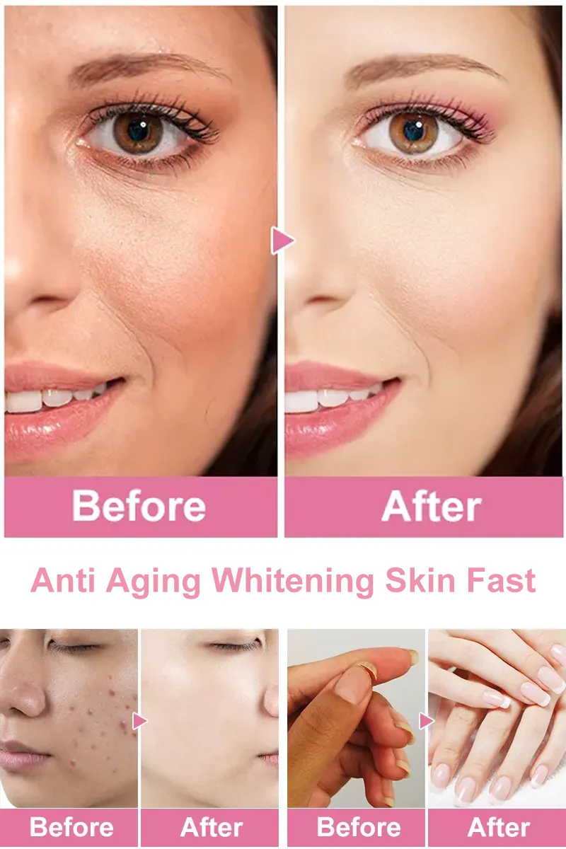 Self-Branded Brightening Skin Tone Probiotic Gummies Whitening Dietary Supplement Melatonin Skin Whitening Gummy
