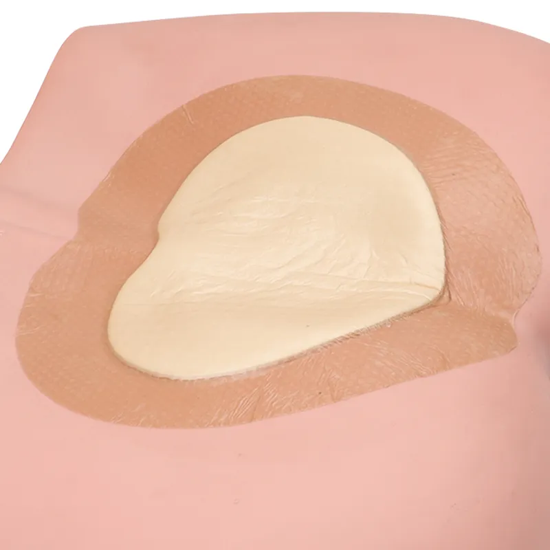 Silicone Foam Dressing 3