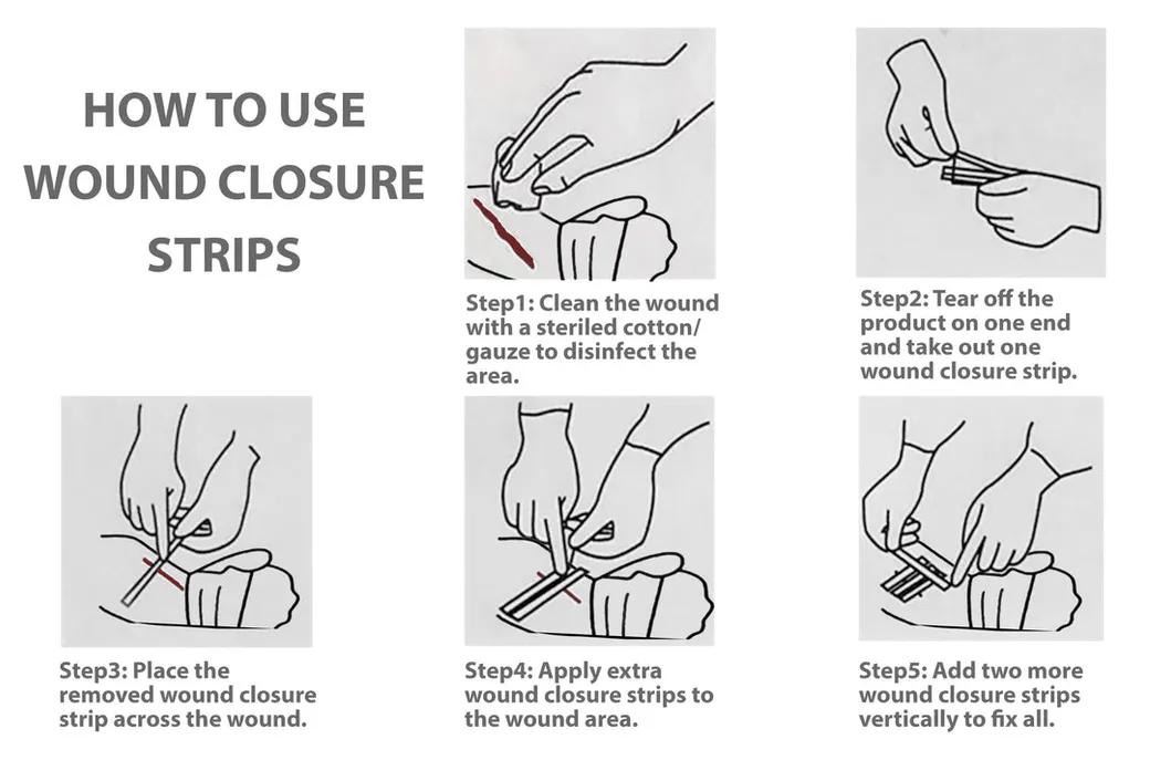 لاصق جراحي disposable لضمادة الجروح مع شريط إغلاق جلدي قوي قابل للاختراق