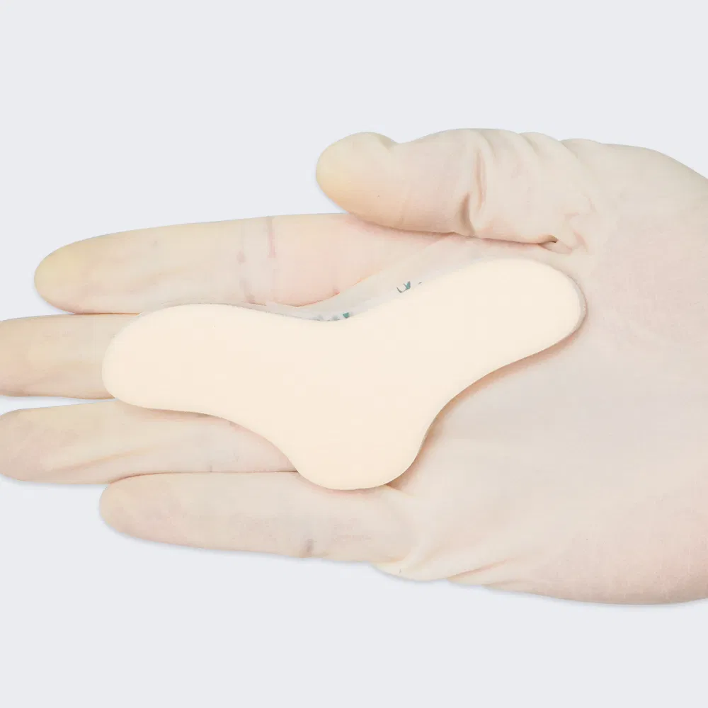 ضمادة طبية معقمة disposable مصنوعة من السيليكون لعلاج الجروح لعلاج قرحات الضغط