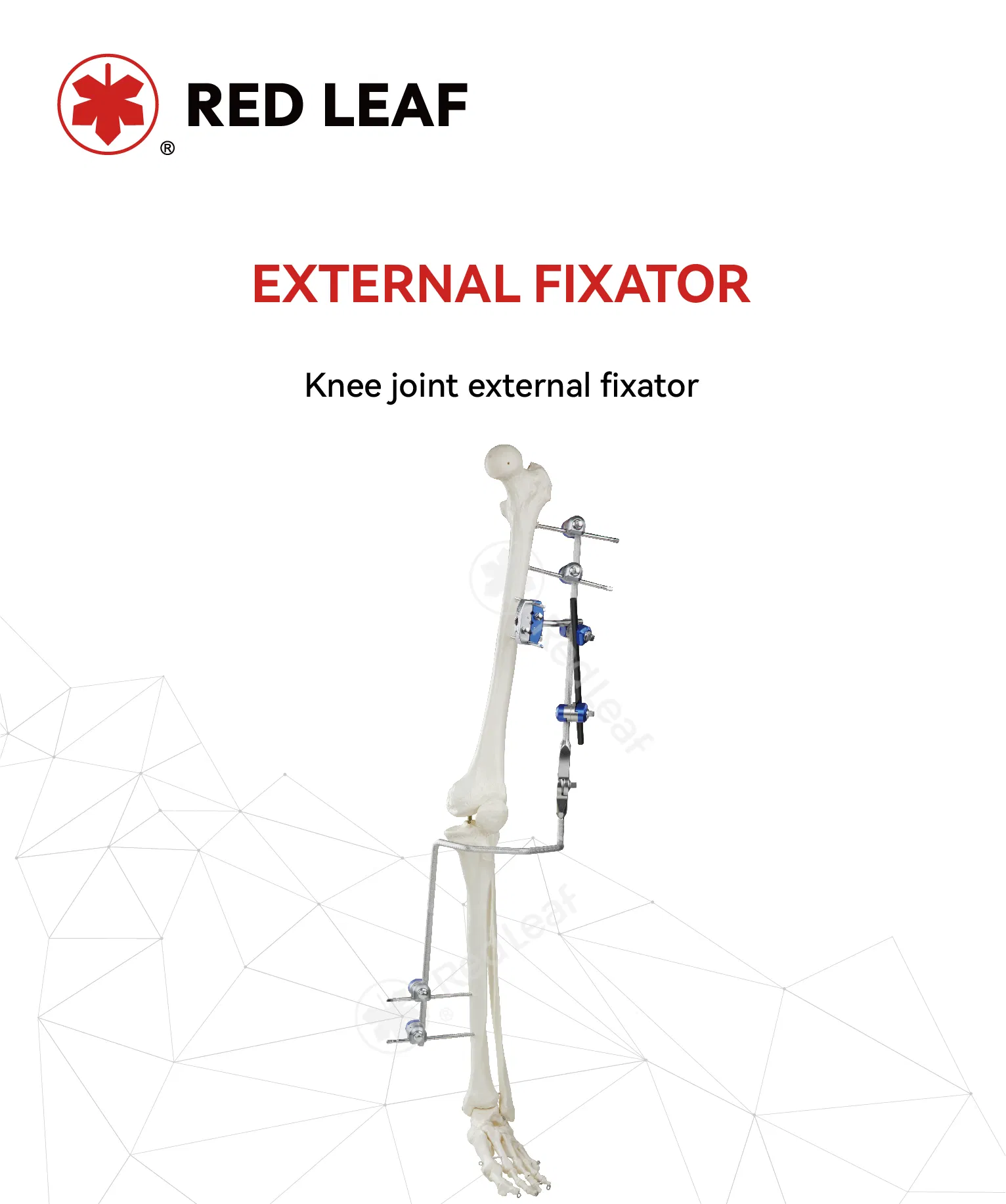 Knee Joint External Fixator