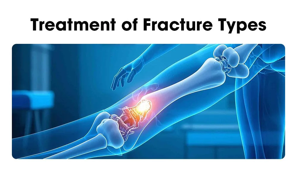 Fracture Treatment