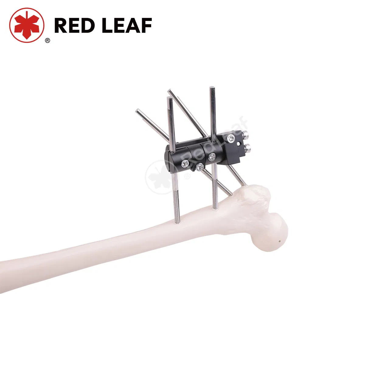 Pertrochanteric Orthopedic External Fixator Medical Extremities Fracture Fixation