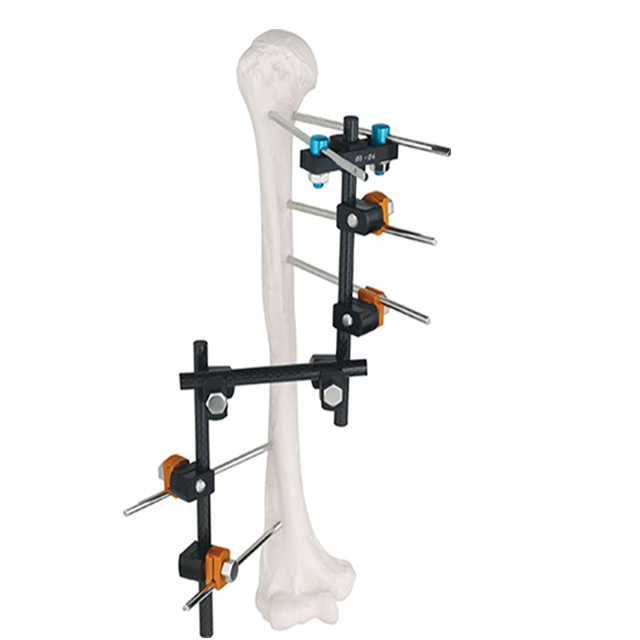 Ao Design Combination T Frameexternal Fixator for Orthopedic Fixation