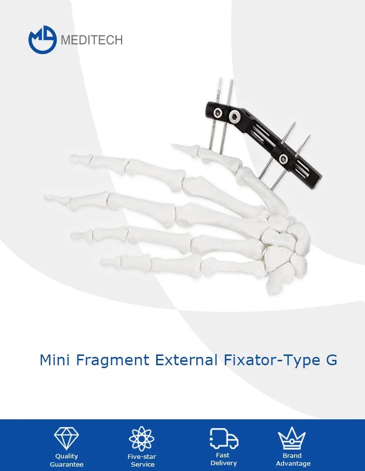 Orthopedic Surgical Instruments
