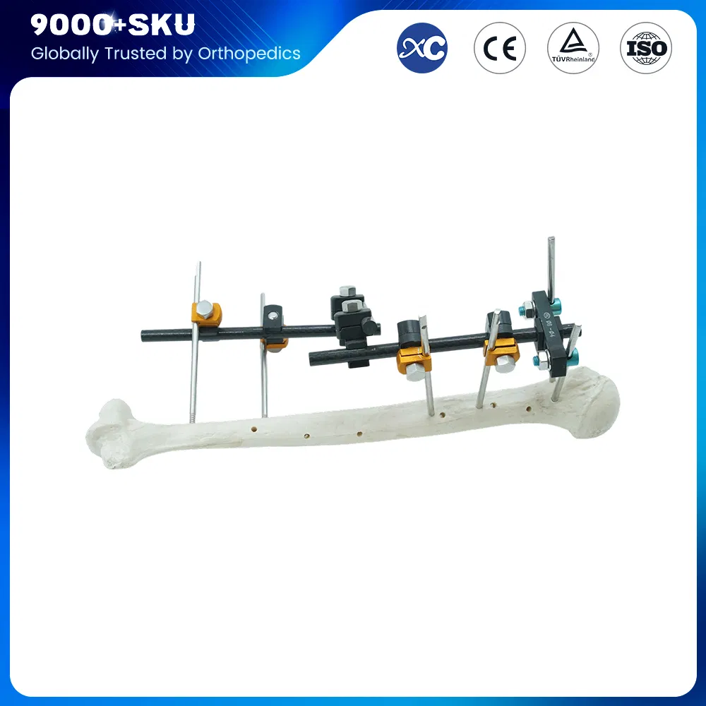 Orthopedic Medical Fracture Fixation Single-Pin Type Upper Limbs Wrist External Fixator