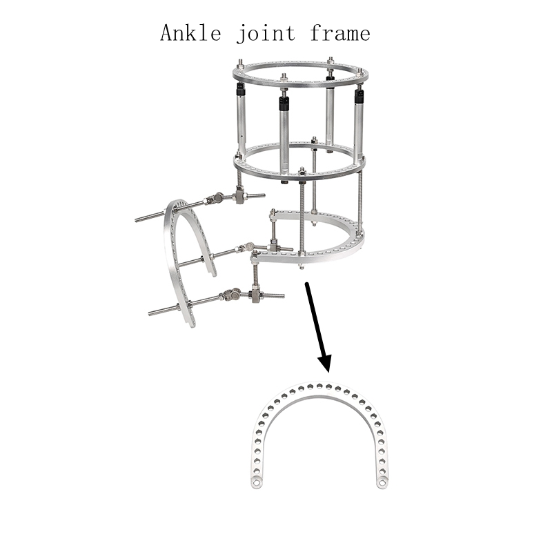 Ilizarov External Fixator U Ring for Ankle Joint Frame