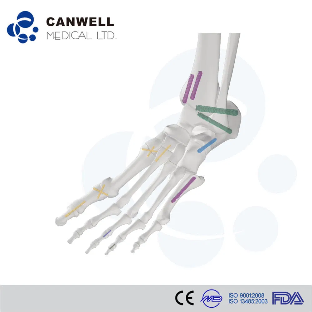 Headless Cannulated Compression Mini Bone Screws, Titanium Orthopedic Locking Screw Implant Medical