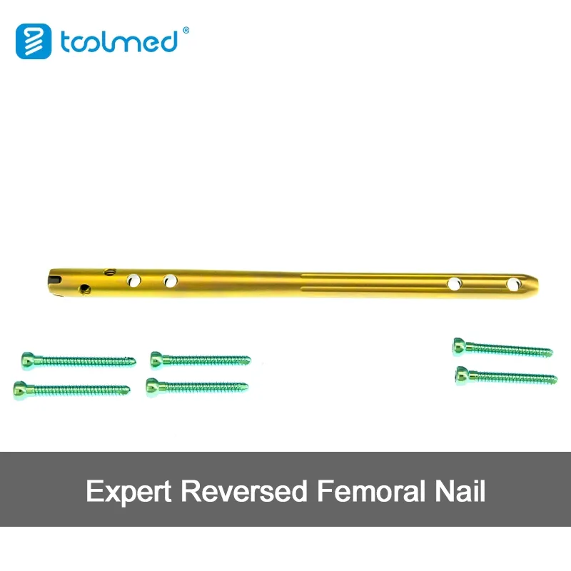 Expert-Level Femoral Nail