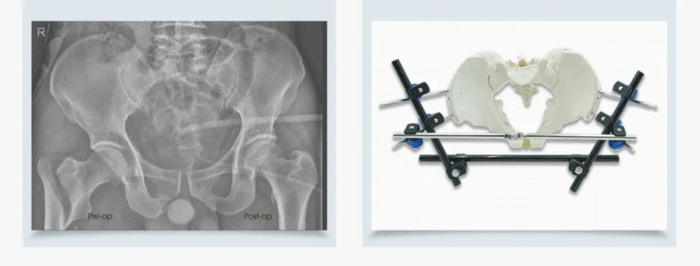 Surgical Case Benefits