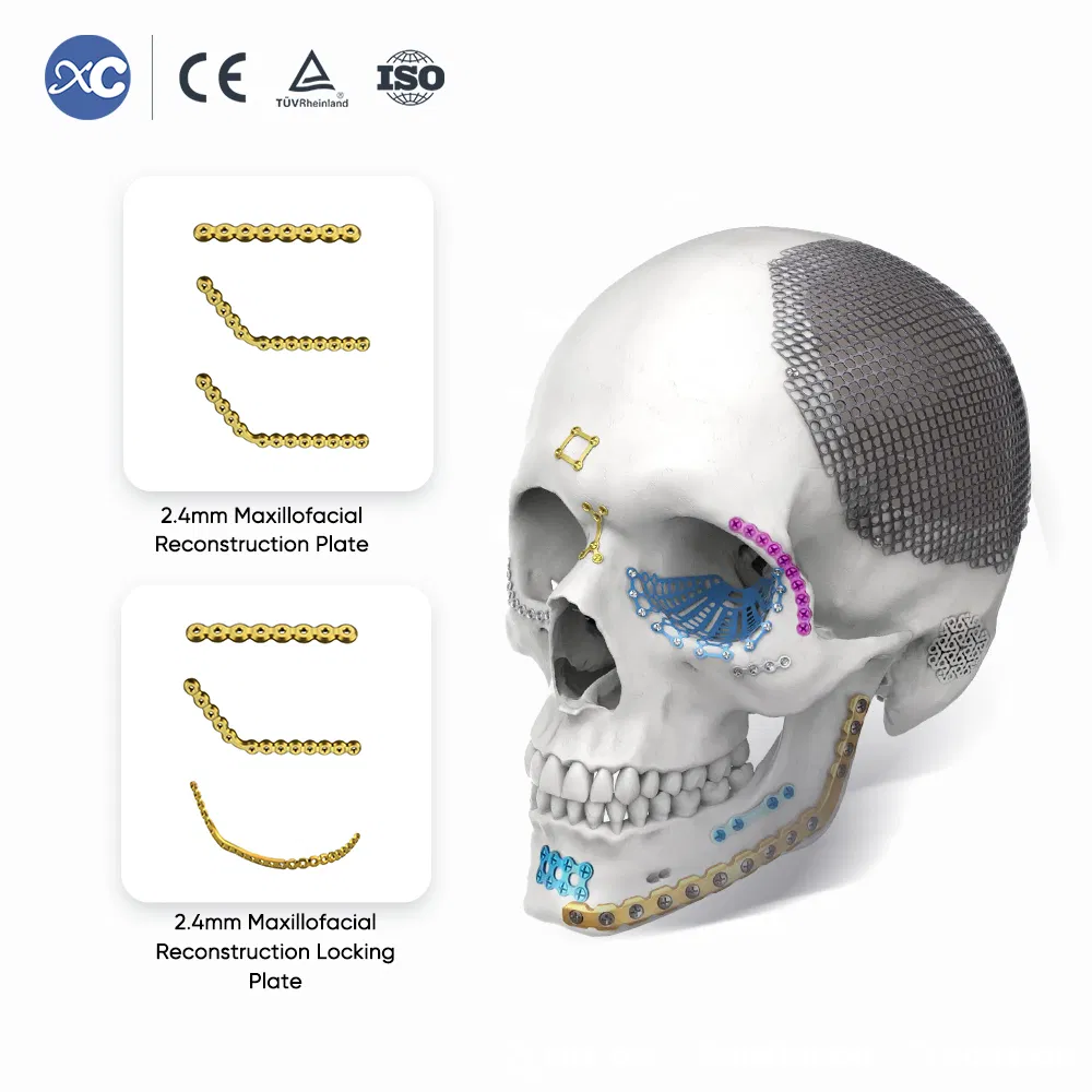 Wholesale Cmf Internal Fixation Surgery Mandible Reconstruction Titanium Maxillofacial Mini Plate Implant