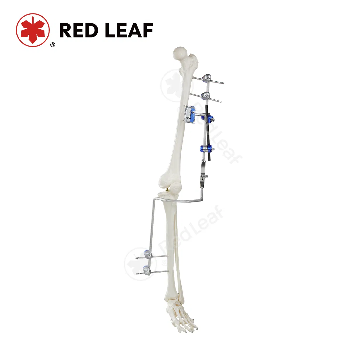 Orthopedic Surgical Instruments Knee Joint External Fixator for Articulatio Genus Fracture