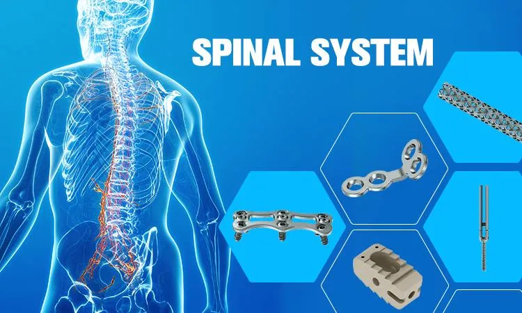 Spine Implant System Overview