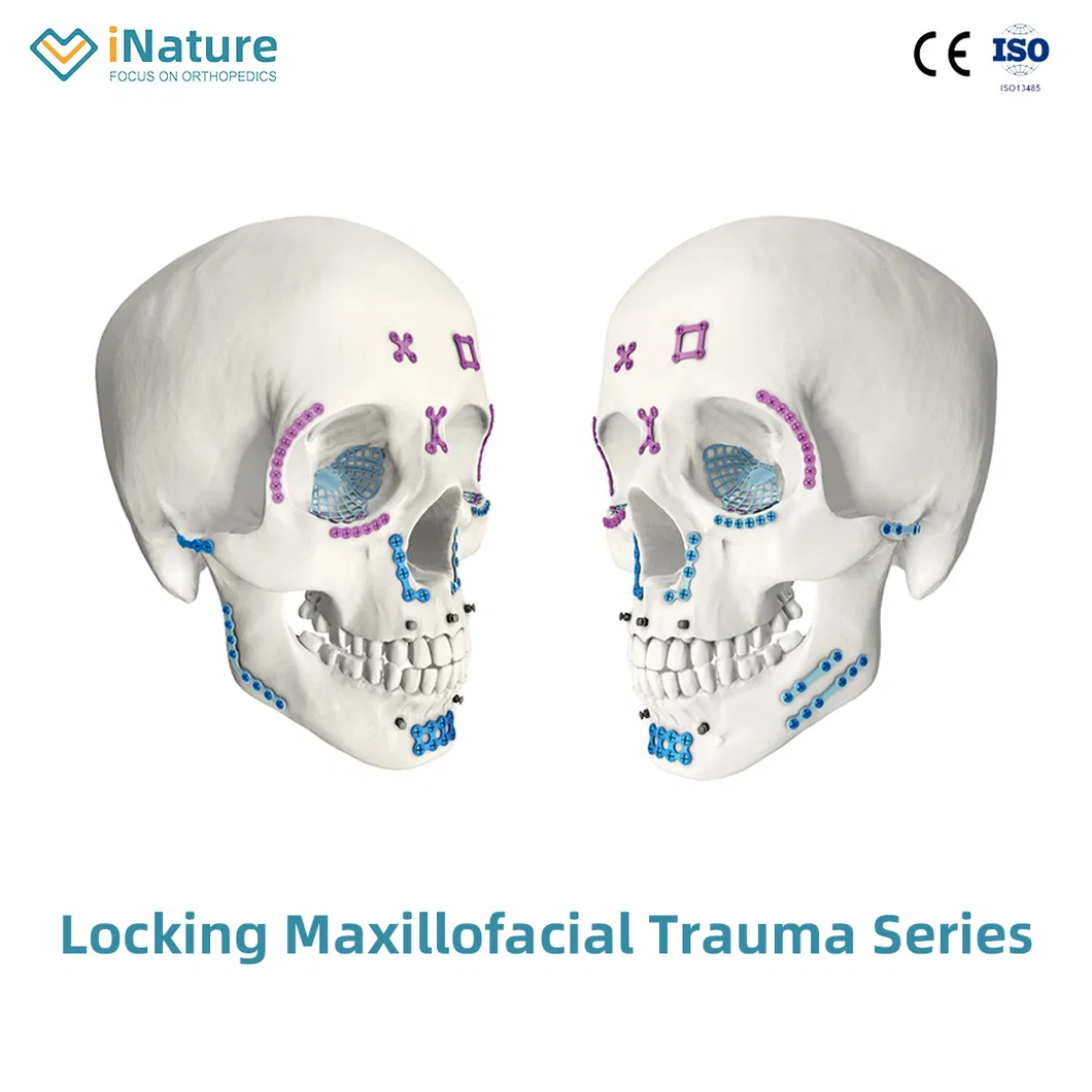Titanium Cranium Implant 1