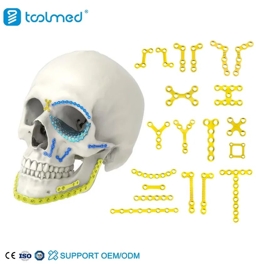 Maxillofacial Plate 1