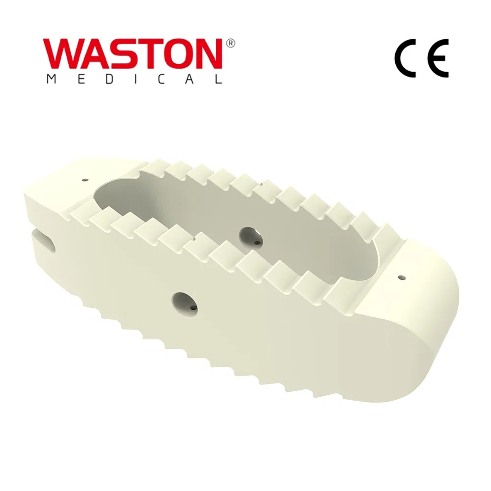 Disposable Surgical Neulen Laminoplasty Inter Pedicle Screw Orthopaedic Instrument Expandable Cage Implant O-Max Cage System