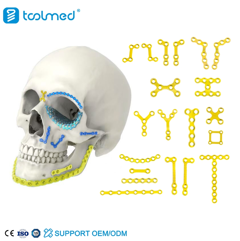 Orthopedic Implant Titanium Alloy Maxillofacial Plates and Screws Locking Plate