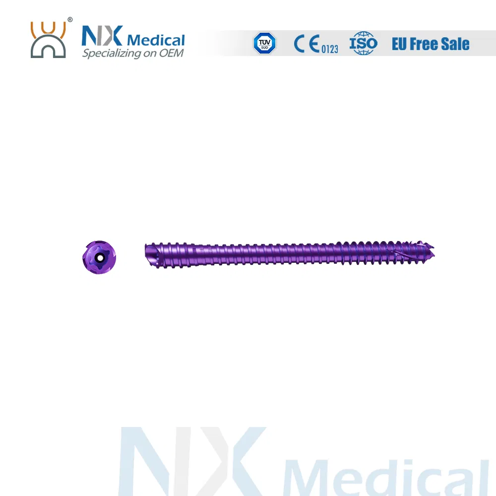 Nx Medical Cannulated Beleved Bunionectomy Screws Minimum Invasive