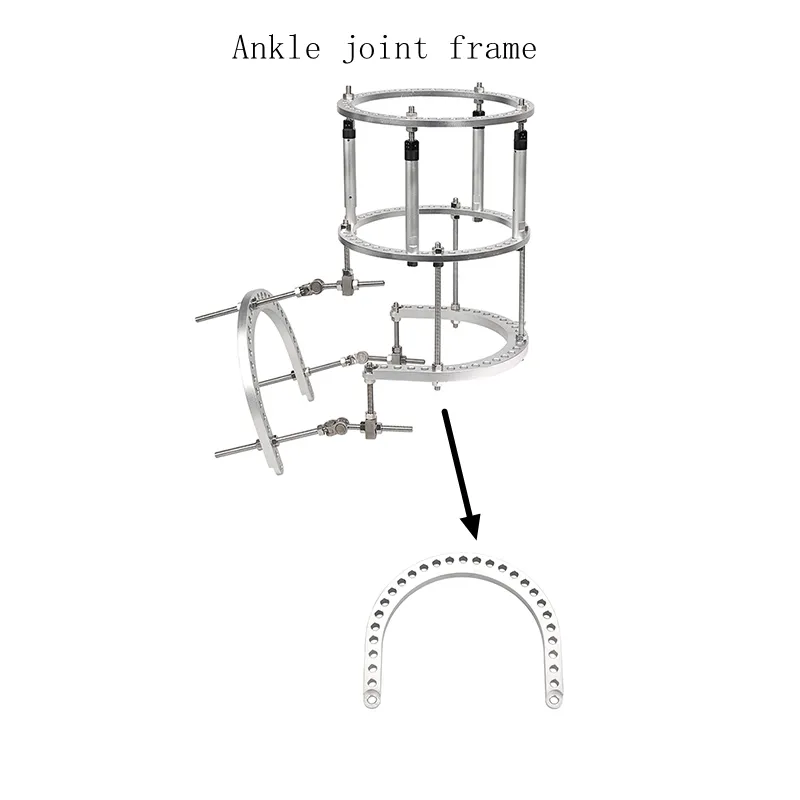 Ilizarov External Fixator U Ring View 2
