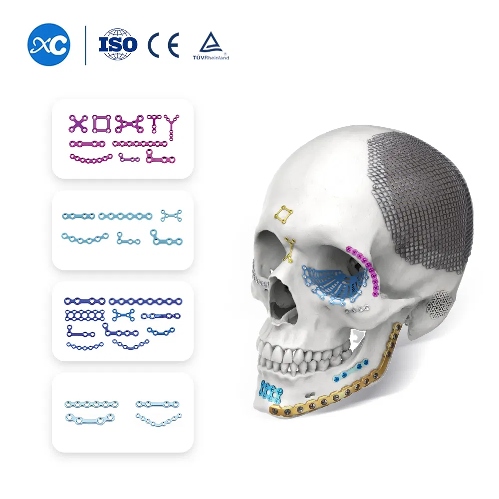 Cmf Orthopedic Medical Maxillofacial Titanium Plate and Screw Locking Implant Plate