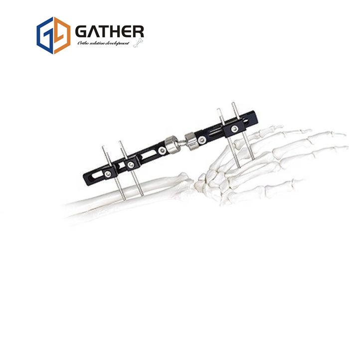 OEM Disposable CE Approved Bone Fracture Distal Radius Waist Support Splint External Fixator