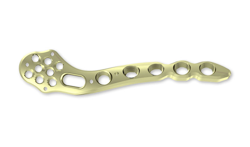 Affordable Multi Axial Locking Plate for Distal Radius