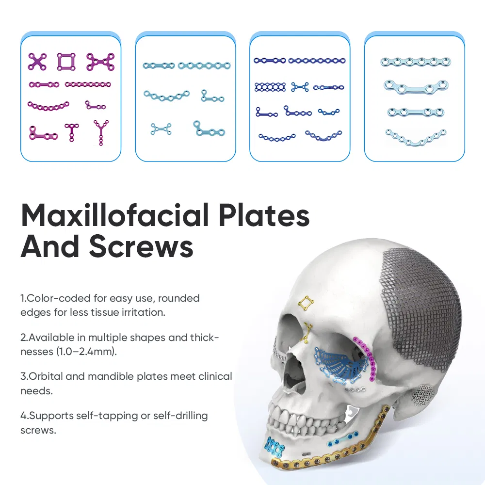 Cmf Orthopedic Medical Maxillofacial Titanium Plate and Screw Locking Implant Plate