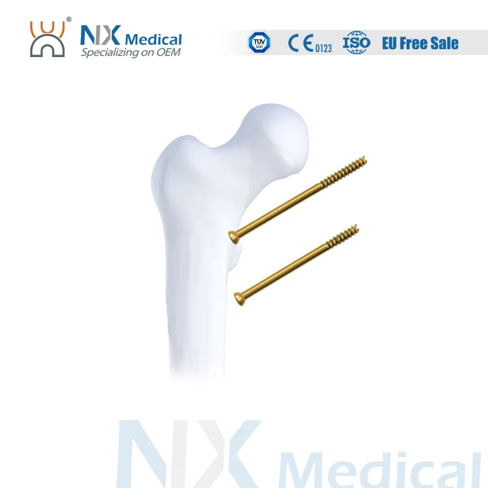 Nx Medical Orthopedic Titanium Implant Cannulated Screw for Bone Fixation