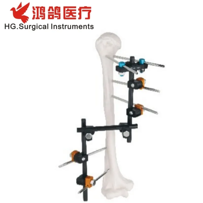 Orthopedic External Fixator 2