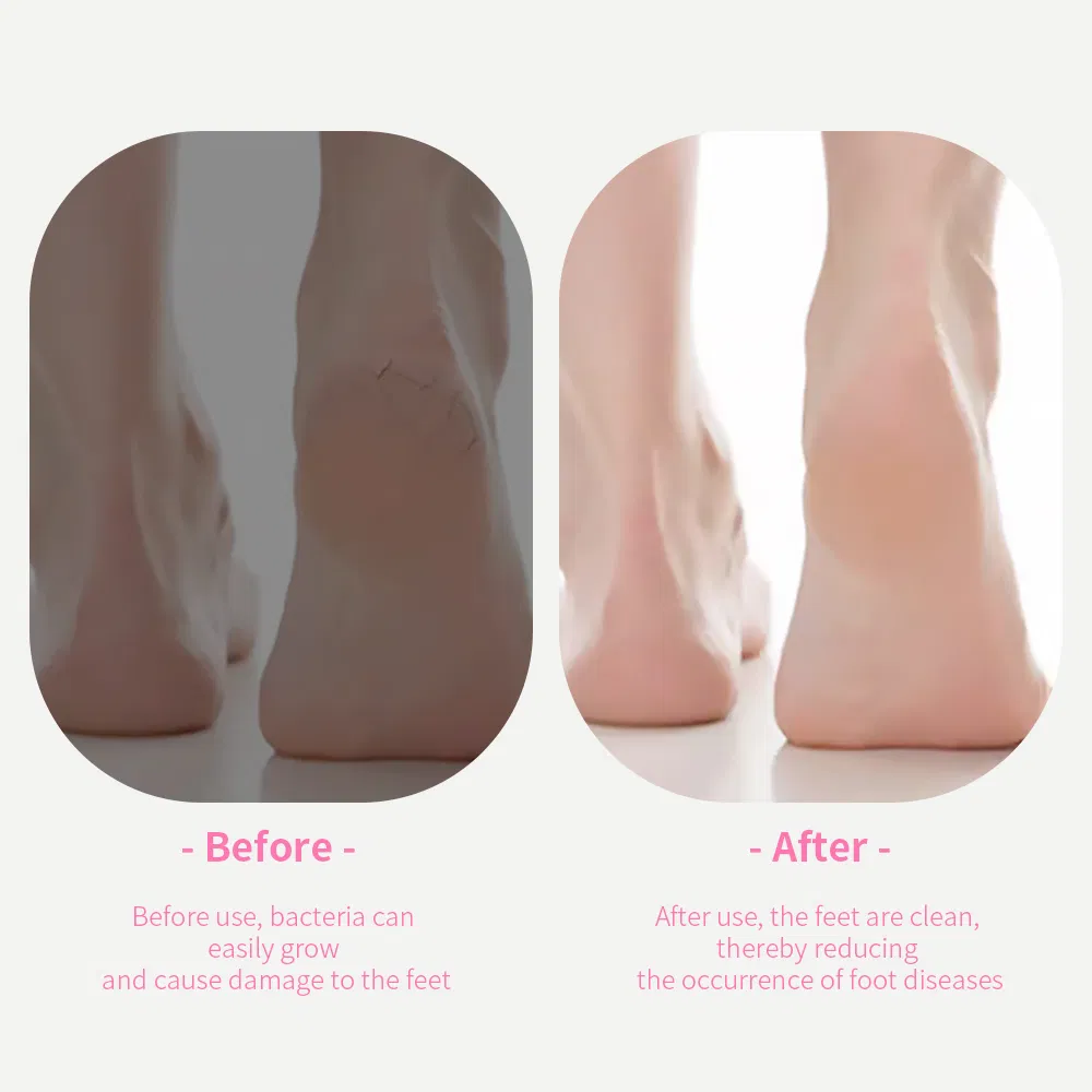Conjunto Profissional de Cuidados com as Unhas em Aço Inoxidável para Manicure e Pedicure, Ferramentas de Beleza para Cuidados com a Pele dos Pés