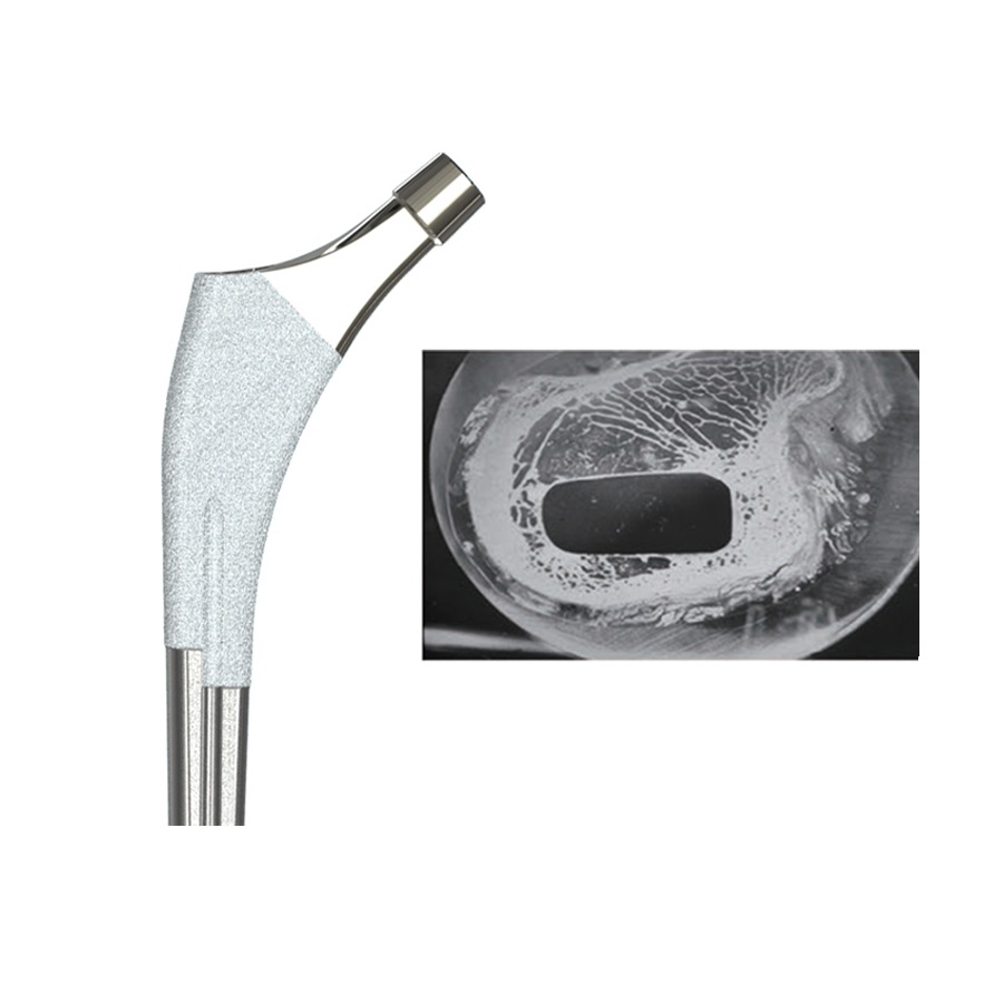 Best Supplier Cementless Femoral Stems Hip Prothesis for Hip Joint THA Surgery Orthopedic Product