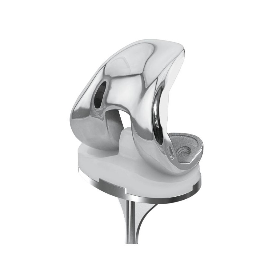Prosthesis Image 1