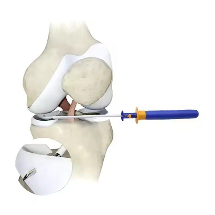 Meniscus Repair System Component