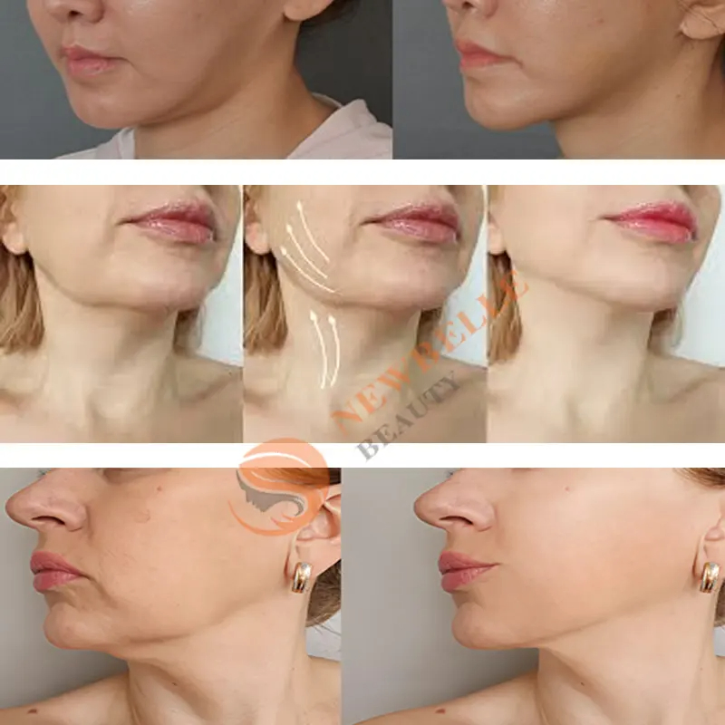 Skin Beauty Equipment SPA Salon Use EMS Microcurrent Gloves Face Lifting Micro Current Microcorriente Machine RF Radio Frequency Massage Facial Toning Device