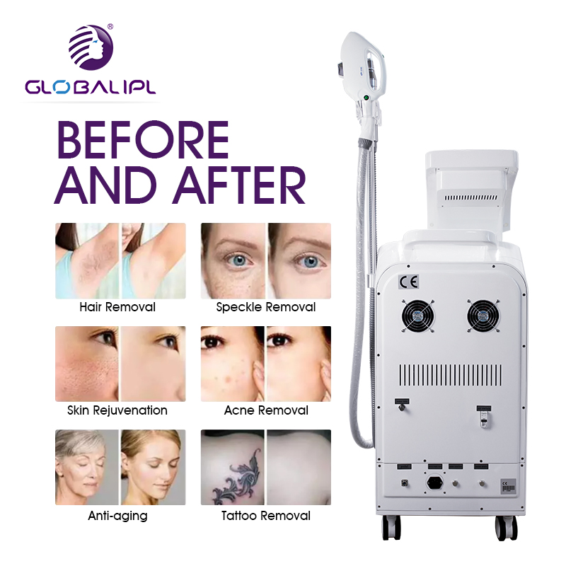 Germany Xenon Lamp E Light IPL 3 in 1 Multifunctional Pico Laser Hair Removal