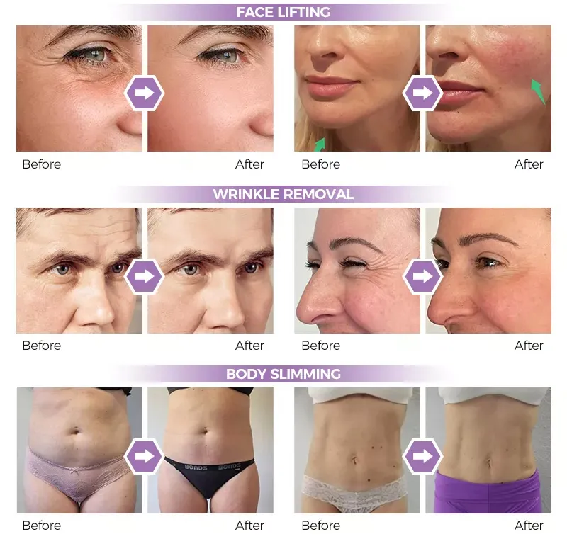 Final Results Visualization