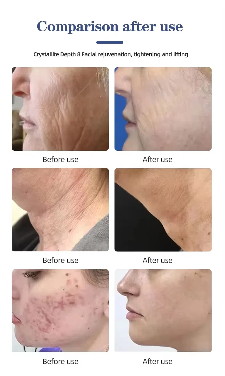 Treatment Results Infographic