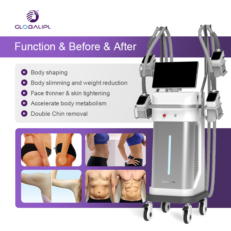 Fat Freezing Machine Cryo Slim Cryotherapy Machine Body Slimming Fat Burning
