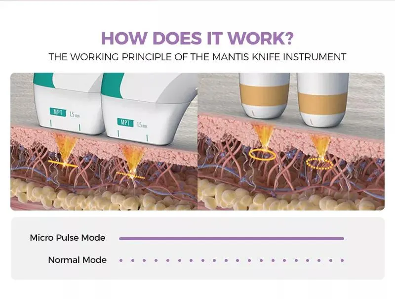 Treatment Technology