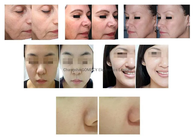 Before and After Results